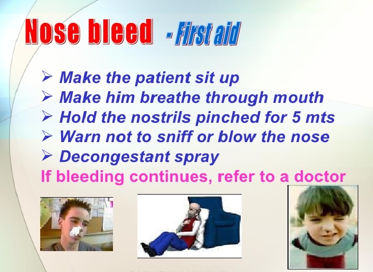 First Aid Training & Treatment for Nosebleed / Bleeding Nose